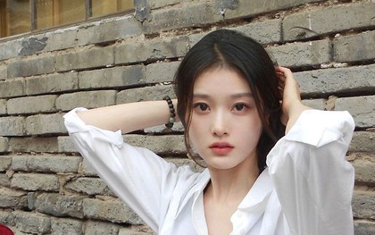 Bất kể nam hay nữ, ăn càng nhiều 5 món này tóc càng rụng "lả tả", hói lúc nào chẳng hay!