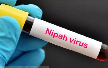 Bác sĩ Bệnh viện Chợ Rẫy chỉ ra 3 con đường lây truyền virus Nipah, nhắc mọi người hiểu đúng để cảnh giác "không hoang mang"