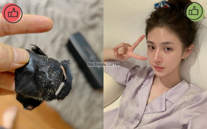 Mẹ tôi từng mua đủ thứ để chăm da, bà bảo tôi rằng có 5 món không nên dùng vì sẽ khiến da xấu đi