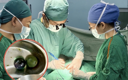 Bé gái 18 tháng tuổi nguy kịch, ruột tắc nghẽn vì nuốt hạt nở đồ chơi