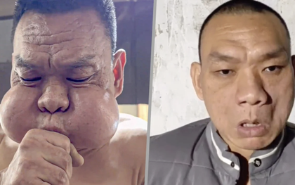 30 năm thổi thủy tinh, gương mặt biến dạng: Nghệ nhân Trung Quốc có đôi má phồng như “ếch”, cái giá không ai muốn trả