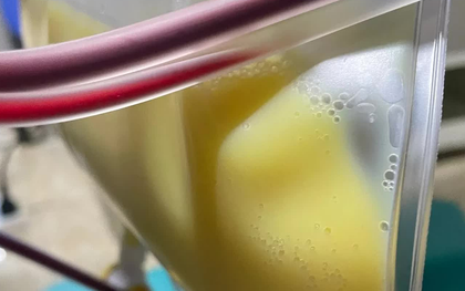 Người phụ nữ 30 tuổi "máu trắng đục như sữa" vì thói quen nhiều người mắc mà không hay
