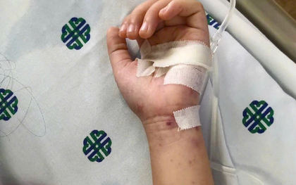 Thêm một ca não mô cầu tại TP.HCM, trẻ đã tiêm vaccine vẫn mắc bệnh: Bác sĩ cảnh báo 4 nhóm người có nguy cơ cao