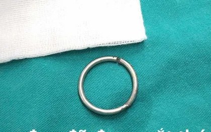Chàng trai 24 tuổi hoại tử, suýt mất "cậu nhỏ" vì đeo 1 thứ để kéo dài thời gian làm "chuyện ấy"