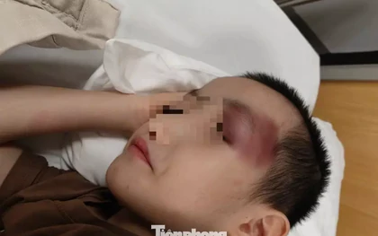 Thông tin mới vụ bé trai 6 tuổi bị chấn thương sọ não khi gửi tại cơ sở can thiệp