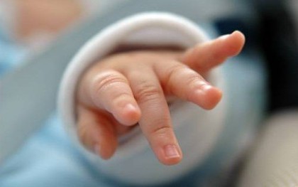 Bé 33 ngày tuổi lờ đờ, thiếu máu nặng, gia đình nói với bác sĩ đã dùng kim khâu chích rạch và đốt đèn chữa bệnh cho con