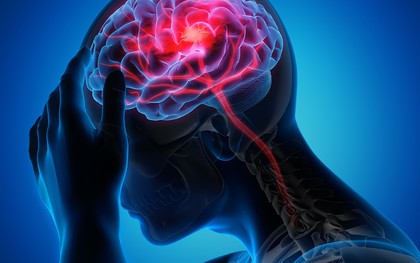 Đang đi mà thấy dấu hiệu này, cẩn thận kẻo đột quỵ đã "gõ cửa"