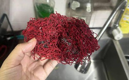 5 loại lưới rửa bát tiếc mấy cũng nên vứt ngay vào sọt rác!