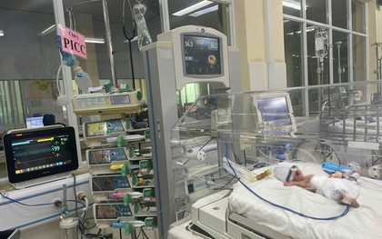 Cứu sống bệnh nhi sinh non nặng 700 gram thủng ruột tự phát