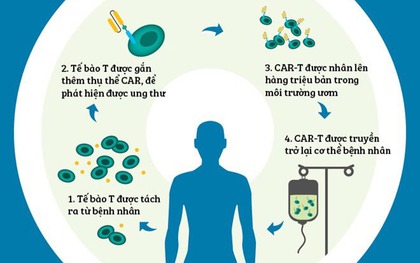 Liệu pháp CAR-T được dùng điều trị ung thư máu là gì?
