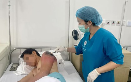 Đừng để "mẹo dân gian" biến chấn thương nhẹ thành nhiễm trùng nặng