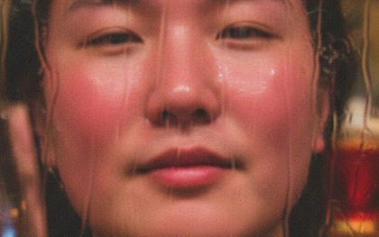 Đỏ mặt, nóng bừng sau uống rượu bia có đáng lo?