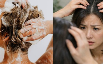 Gội đầu không đúng có thể đẩy nhanh quá trình tóc bạc! Các chuyên gia tiết lộ các bước gội đầu đúng cách
