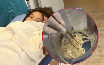 Một phụ nữ 32 tuổi thải ra sinh vật sống DÀI 3 MÉT, bác sĩ chỉ đích danh kiểu dùng thớt "gây hoạ" nhưng cực quen