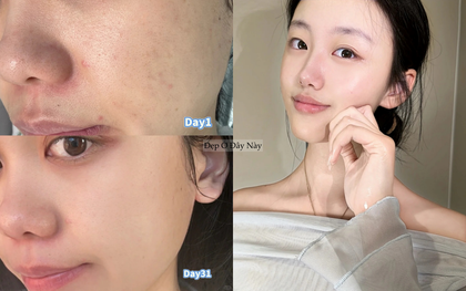 5 chiêu "vàng ngọc" khi dùng serum giúp làn da tuổi 25+ luôn khỏe đẹp