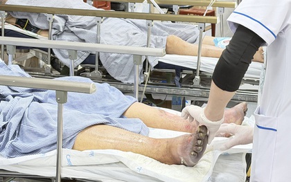 5 bệnh dễ mắc sau Tết