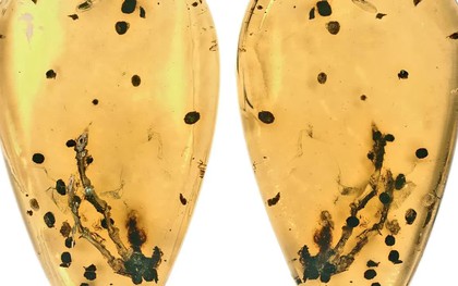 Hé lộ manh mối về nguồn gốc của bệnh u xương