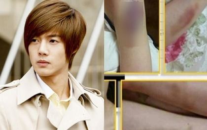 Bí mật động trời của Kim Hyun Joong (Vườn Sao Băng) sau 11 năm mới được công bố