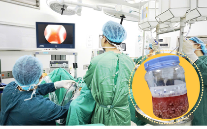 Kỳ tích y học Việt Nam: Cụ ông 94 tuổi được bóc u tiền liệt tuyến to gấp 5 lần bình thường