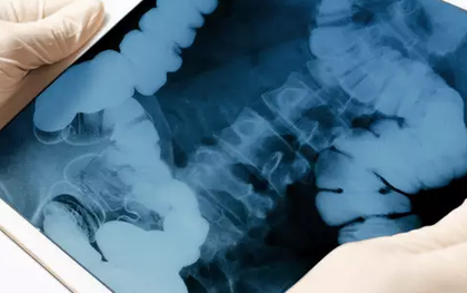 Cả bệnh viện hoảng loạn, sơ tán ngay lập tức vì điều này ở chàng trai 24 tuổi