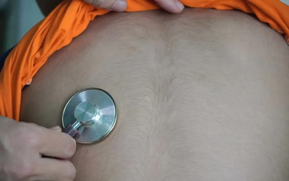 Nguy cơ suy thượng thận khi tự ý dùng thuốc corticoid