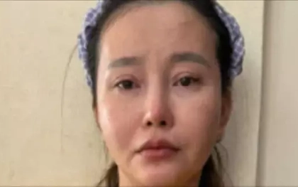 Nữ bị can phẫu thuật thẩm mỹ để trốn truy nã vẫn không thoát