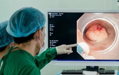 Sụt 5kg trong 1 tháng, người đàn ông 47 tuổi mắc cùng lúc 2 bệnh ung thư: Thủ phạm từ thói quen uống 300ml loại đồ uống này mỗi ngày