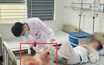 Suýt mất chân vì đắp lá chữa bỏng lửa suốt 1 tháng