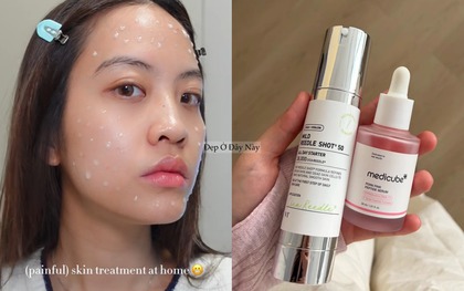 Serum vi kim: Bôi lên là thấy châm chích nhẹ, da cải thiện thấy rõ nhưng cần thời gian làm quen