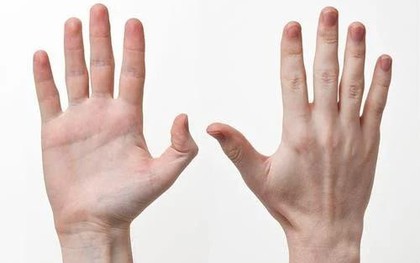 3 BẤT THƯỜNG ở bàn tay cảnh báo bệnh ung thư: Nhiều người gặp phải nhưng chủ quan bỏ qua