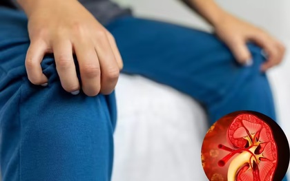 Muốn biết thận khỏe hay yếu, cứ nhìn vào tay và chân sẽ rõ: Có 7 dấu hiệu này thì phải đi khám sớm!