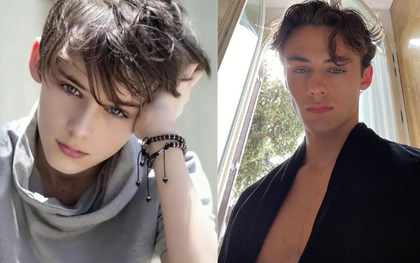 "Cậu bé đẹp trai nhất thế giới" sau 10 năm: Hiện tại cao 1m90, visual có còn sức hút?