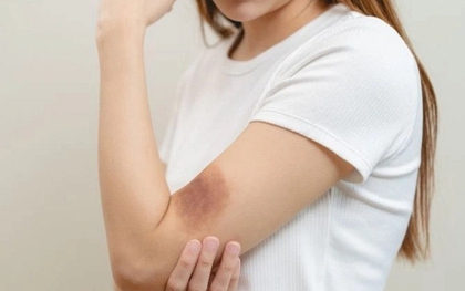 Muốn biết gan khỏe hay yếu, chỉ cần nhìn vào làn da sẽ rõ: Có 5 dấu hiệu này phải đi khám ngay