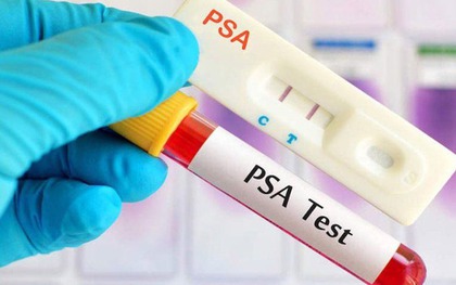 3 ca ung thư tuyến tiền liệt trong 1 ngày, bác sĩ chỉ lý do bệnh dễ bị bỏ sót