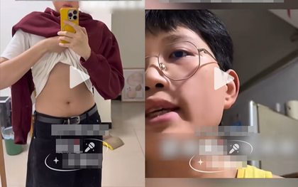 Nam thanh niên 32 tuổi mới "dậy thì", phát triển ngực như phụ nữ, bác sĩ sốc khi nồng độ hormone nam chỉ dưới 0.1