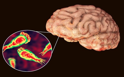 Rất có thể bạn đã bị nhiễm một loại virus ăn não mà bạn chưa từng nghe đến