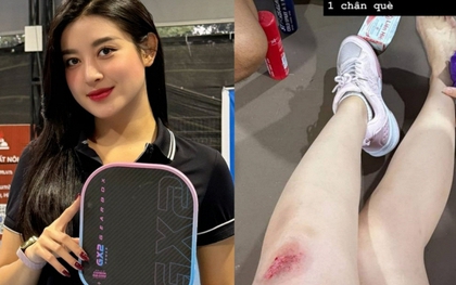 Á hậu Huyền My gặp tai nạn khi chơi pickleball