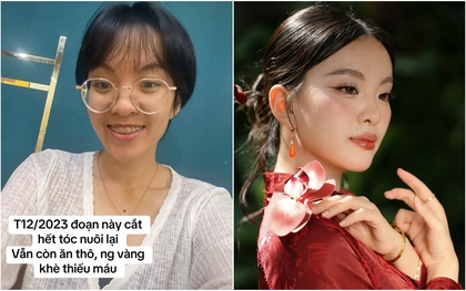 Màn thay đổi "đáng đồng tiền" của cô gái TP.HCM sau khi từ bỏ ăn thô, niềng răng và mổ mắt cận