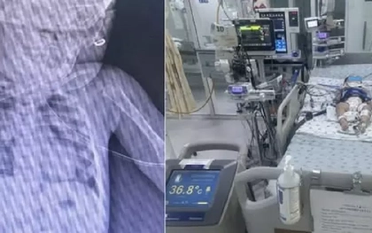 Bé gái mới biết đi bị ngã vào thùng nước khiến ngưng tim ngưng thở