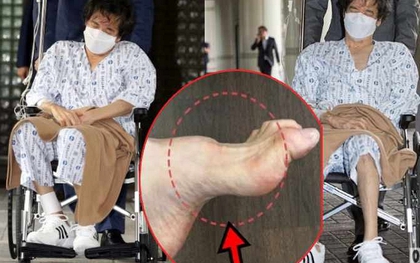 Gia tộc Samsung và căn bệnh di truyền đáng sợ mang tên teo cơ MÁC: Có tất cả nhưng cũng không thể chữa khỏi