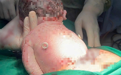 Em bé sinh ra với "đôi cánh nhỏ" trên lưng: Mẹ ơi! Con đến với mẹ rồi đây!