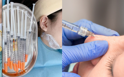 Cô gái ở TP.HCM gặp biến chứng sau mũi tiêm 27 triệu tại nhà, người thực hiện "mất tích bí ẩn" khiến ai cũng rùng mình