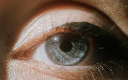 Đến năm 2050, một nửa dân số thế giới sẽ bị cận thị!