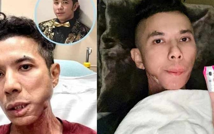 Chi phí điều trị bệnh của Kasim Hoàng Vũ bên Mỹ "khủng" ra sao?