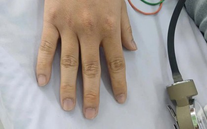 Chẩn đoán chính xác ca bệnh Methemoglobin hiếm gặp, cứu sống bệnh nhân trẻ