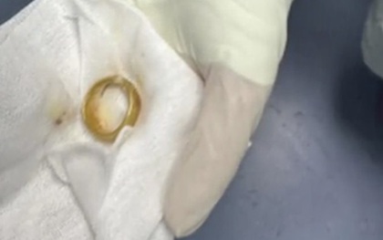 Khám cho cụ ông, bác sĩ phát hiện ra "bí mật" bất ngờ