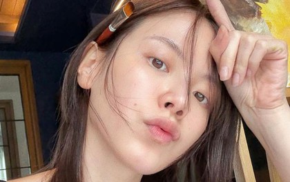 Bác sĩ cho biết 4 cách loại bỏ đốm nâu tại nhà: Không khó để áp dụng, còn nâng cấp da đẹp toàn diện