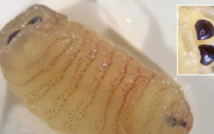 Người phụ nữ 58 tuổi “sốc nặng” khi hắt hơi ra hàng loạt con giòi sống từ trong mũi