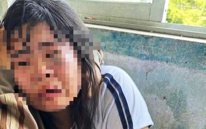 Nữ sinh lớp 7 bị 2 nam sinh lớp 9 đánh nhập viện