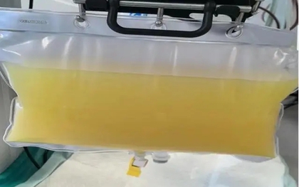 Rút ra 2 lít máu trắng đục như sữa từ cô bé 12 tuổi, bố mẹ oà khóc: "Tưởng cháu đau bụng vì ăn đồ không sạch"